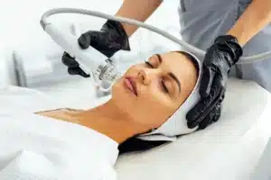 microneedling-service-june-2025-special